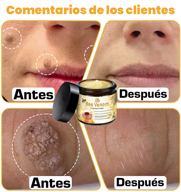 🐝 Paga 1 - Lleva 2🎁 ✨Bee Venom Treatment Cream 🐝