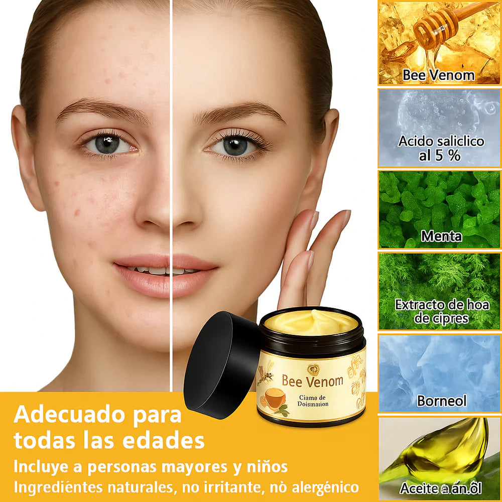 🐝 Paga 1 - Lleva 2🎁 ✨Bee Venom Treatment Cream 🐝